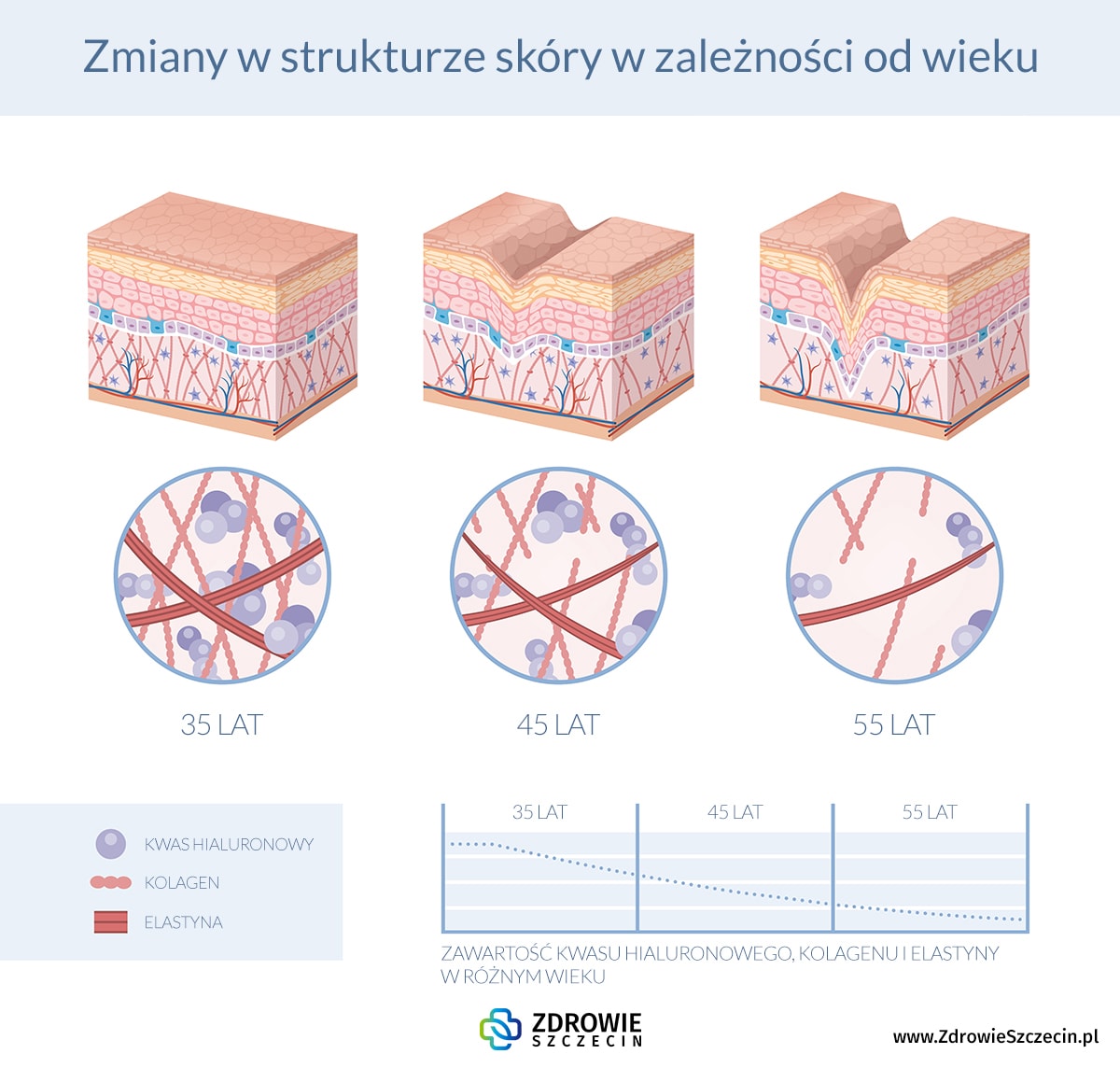 medycyna estetyczna Szczecin, kwas hialuronowy Szczecin